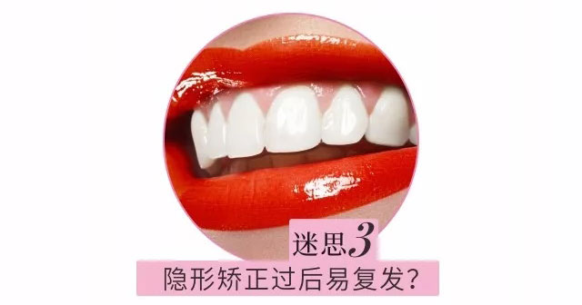 隱形矯正過后易復發(fā)？