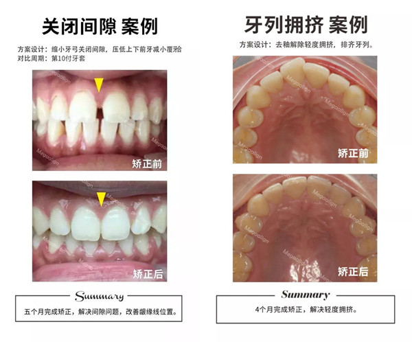 美加易齊微矯案例