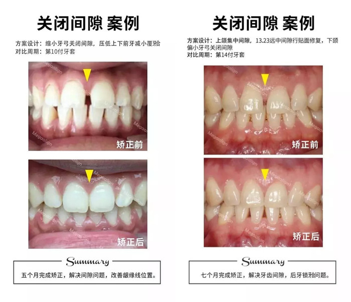 易齊微矯案例賞析