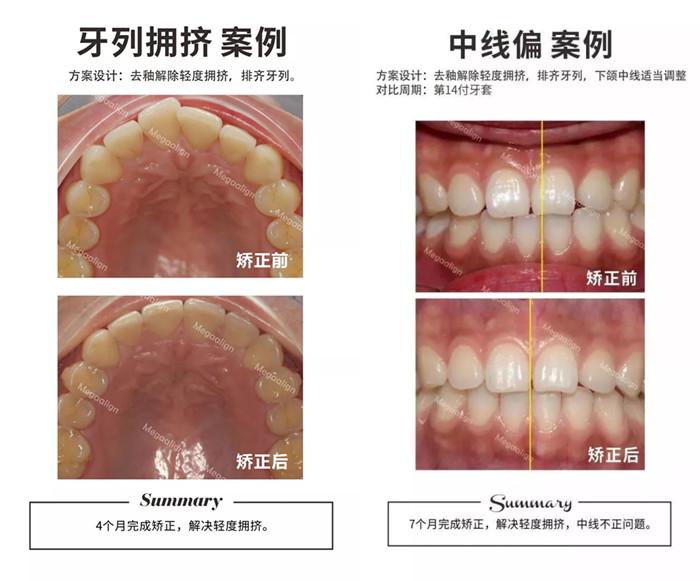 易齊微矯案例賞析