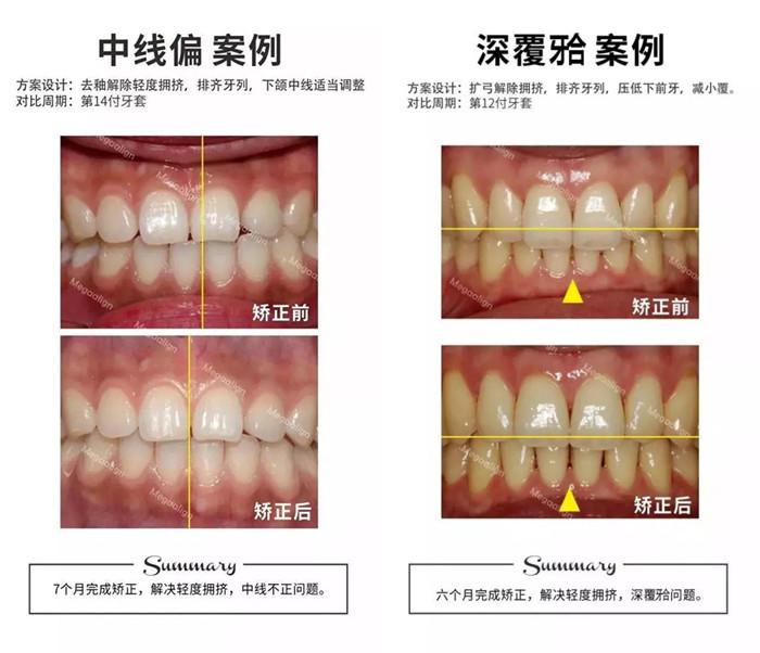 易齊微矯案例