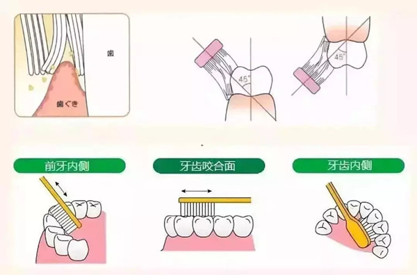 Bass刷牙法示例