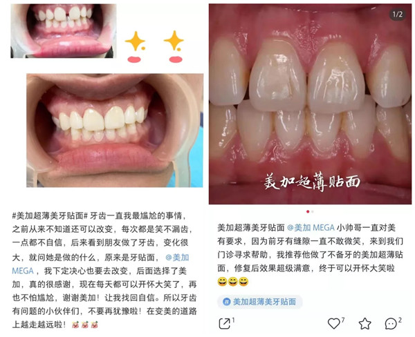 小紅書上那么多人在用的美加貼面，我該怎么買？