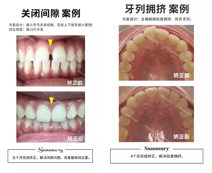 美加易齊微矯案例