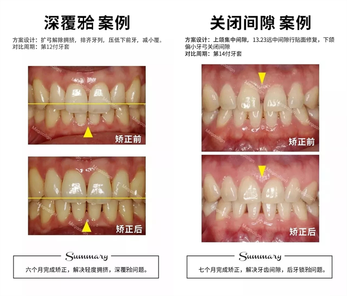 美加易齊微矯案例