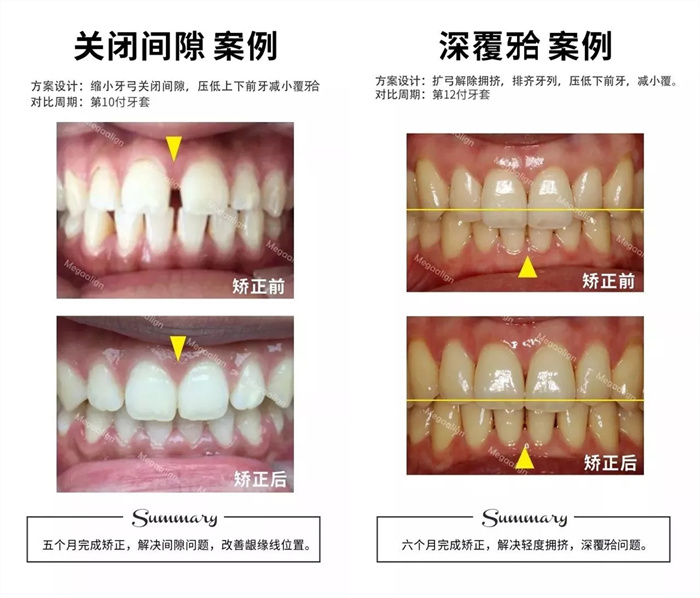 美加易齊微矯案例