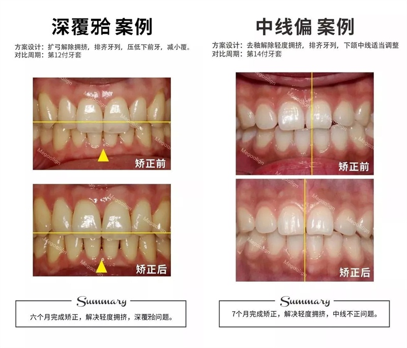 易齊微矯案例