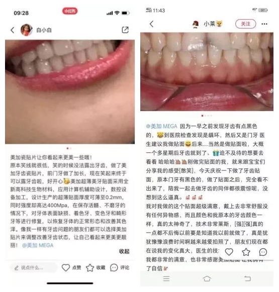 小紅書上小姐姐在種草美加貼面