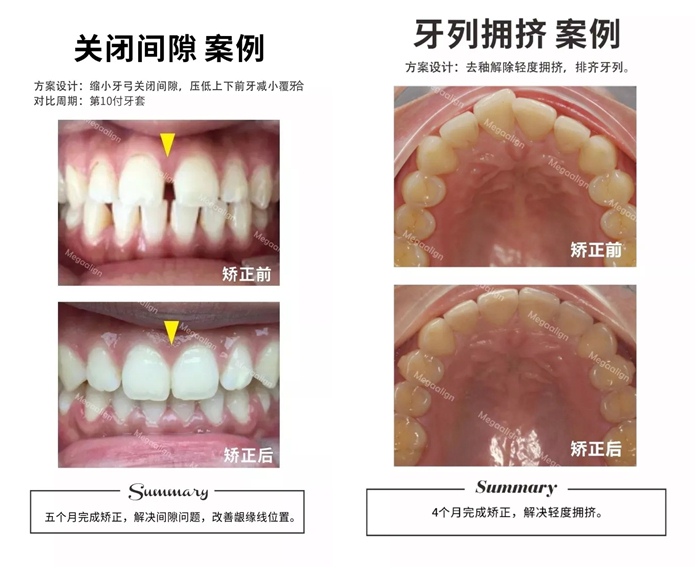 易齊微矯案例