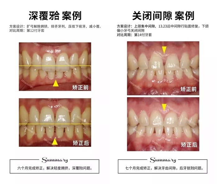 易齊微矯案例