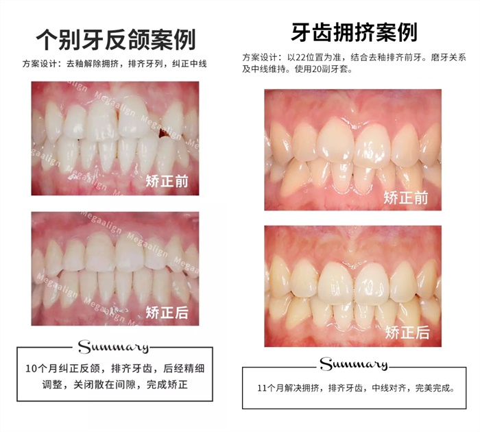 易齊微矯案例