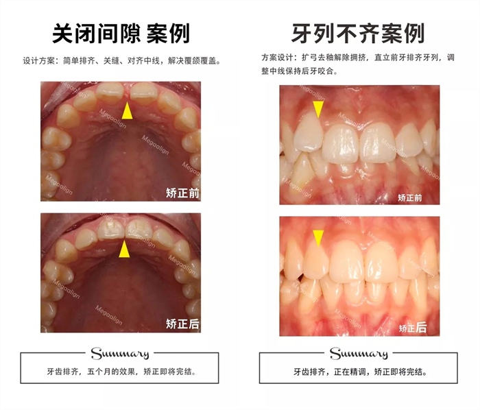 易齊微矯案例