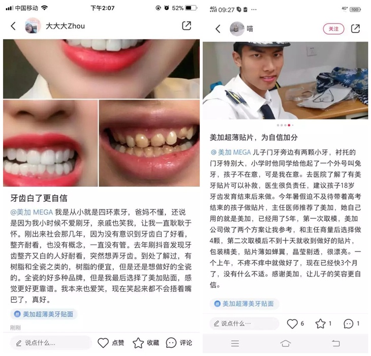 為什么他們都愿意在小紅書上種草美加貼面？