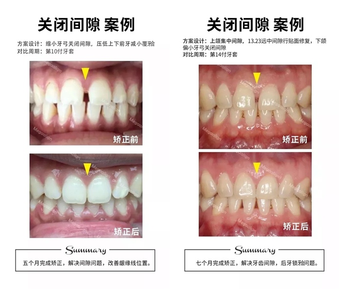 易齊微矯方案案例