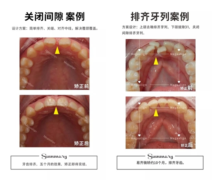 易齊微矯方案案例