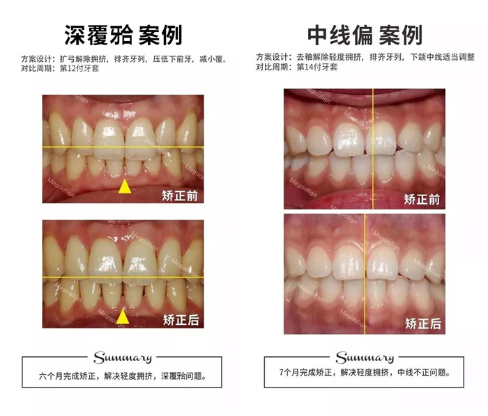 易齊微矯案例