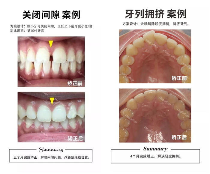 易齊微矯案例