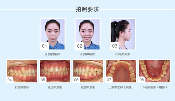 上傳的照片參考