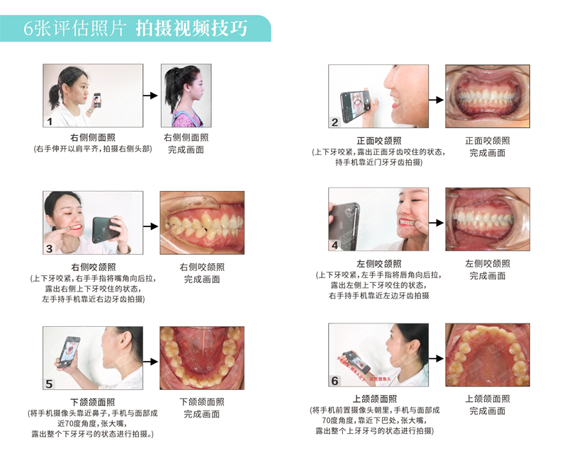 如何視頻面診