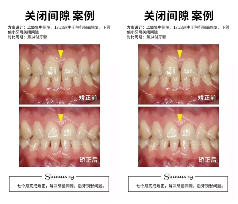 易齊微矯案例