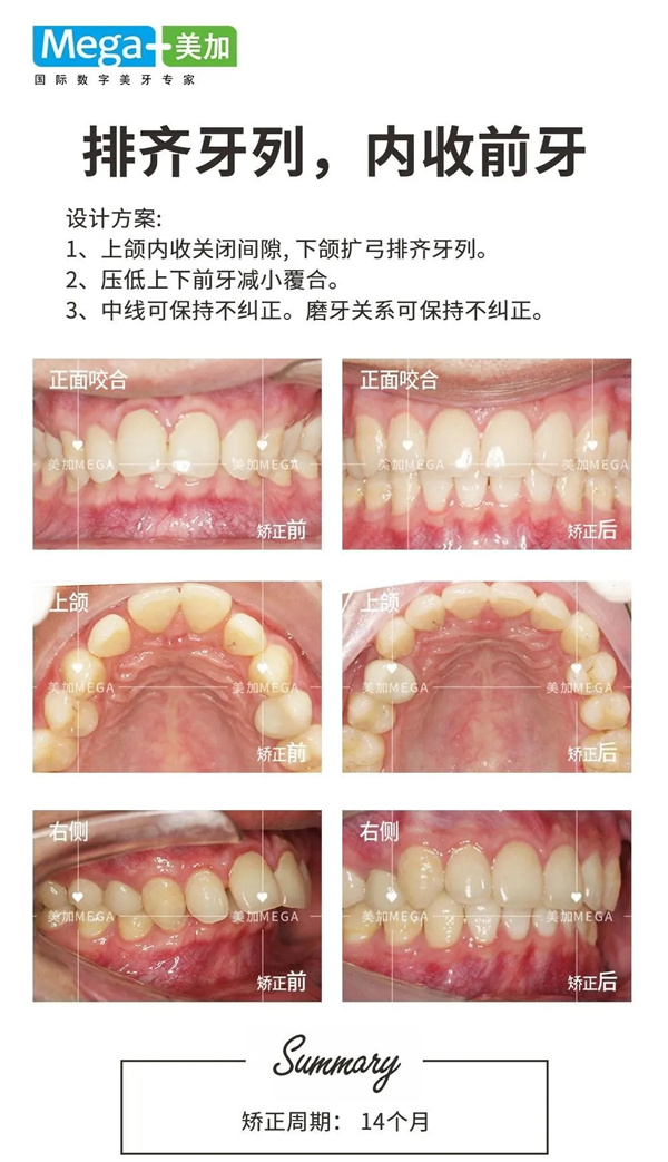 易齊微矯案例分享