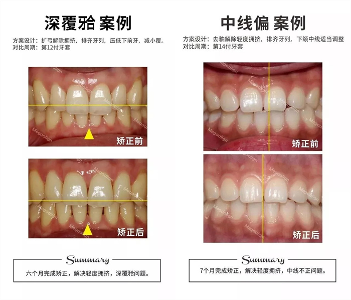 美加易齊微矯案例